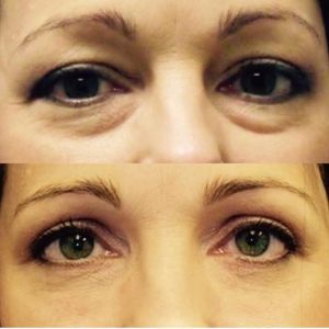 پلاسماجت